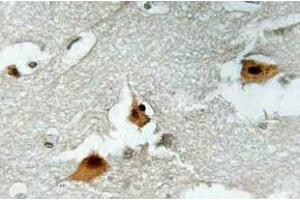 Immunohistochemistry (IHC) analyzes of p-AFX1 in paraffin-embedded human brain tissue. (FOXO4 抗体  (pSer197))