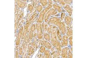 Immunohistochemistry (IHC) image for anti-Chloride Intracellular Channel 4 (CLIC4) (AA 1-253) antibody (ABIN6138723)