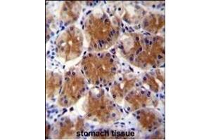 FC1 Antibody (Center) (ABIN655232 and ABIN2844836) immunohistochemistry analysis in formalin fixed and paraffin embedded human stomach tissue followed by peroxidase conjugation of the secondary antibody and DAB staining. (ABHD17C 抗体  (AA 92-121))