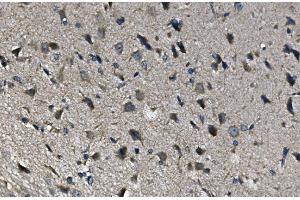 IHC analysis of ADRA1A using anti-ADRA1A antibody (ABIN3043732). (alpha 1 Adrenergic Receptor 抗体  (C-Term))