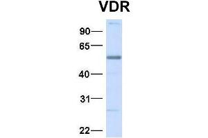 Host:  Rabbit  Target Name:  VDR  Sample Type:  Human Adult Placenta  Antibody Dilution:  1.