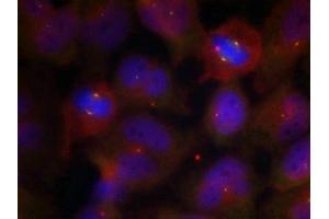 Immunofluorescence staining of methanol-fixed Hela cells using Synaptotagmin 1/2 (Phospho-Thr202/199) Antibody.