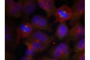 Immunofluorescence staining of methanol-fixed Hela cells using Synaptotagmin 1/2 (Phospho-Thr202/199) Antibody. (SYT1/SYT2 (pThr199), (pThr202) 抗体)