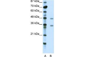 WB Suggested Anti-CBX8 Antibody Titration:  2. (CBX8 抗体  (C-Term))