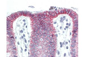 Anti-CTNNB1 / Beta Catenin antibody IHC of human colon. (CTNNB1 抗体  (C-Term))