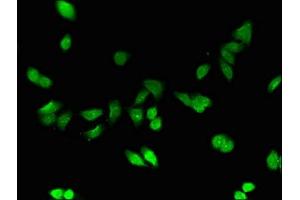 Immunofluorescent analysis of HepG2 cells using ABIN7159517 at dilution of 1:100 (MT1E 抗体  (AA 4-59))