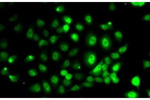 Immunofluorescence analysis of MCF7 cells using PPP2R1B Polyclonal Antibody (PPP2R1B 抗体)