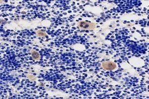 Immunohistochemistry analysis of paraffin-embedded rat bone using,TMEM177 (ABIN7075996) at dilution of 1: 1000 (TMEM177 抗体)