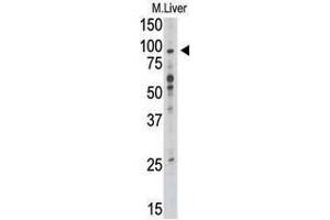 Image no. 1 for anti-Toll-Like Receptor 6 (TLR6) (C-Term) antibody (ABIN357053) (TLR6 抗体  (C-Term))