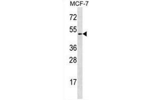 Western blot analysis in MCF-7 cell line lysates (35ug/lane) using Ladinin-1  Antibody (N-term). (Ladinin 1 抗体  (N-Term))