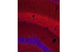 Indirect immunostaining of PFA fixed mouse hippocampus section (dilution 1 : 500; red). (TUBB3 抗体)