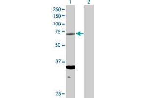 Western Blotting (WB) image for anti-Excision Repair Cross-Complementing Rodent Repair Deficiency, Complementation Group 2 (ERCC2) (AA 1-760) antibody (ABIN515383)