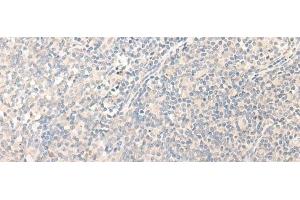 Immunohistochemistry of paraffin-embedded Human tonsil tissue using RADIL Polyclonal Antibody at dilution of 1:40(x200) (Radil 抗体)