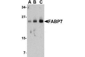 Western blot analysis of FABP7 in human breast tissue lysate with AP30326PU-N FABP7 antibody at (A) 0. (FABP7 抗体  (Center))