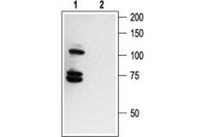 Western blot analysis of human melanoma cells A875:1. (Nerve Growth Factor Receptor (NGFR) Peptide)