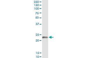 Immunoprecipitation of EDN1 transfected lysate using anti-EDN1 monoclonal antibody and Protein A Magnetic Bead , and immunoblotted with EDN1 MaxPab rabbit polyclonal antibody. (Endothelin 1 抗体  (AA 113-212))