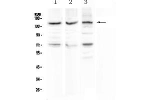 Western blot analysis of CD163 using anti-CD163 antibody . (CD163 抗体  (AA 47-201))