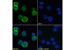 Immunofluorescence staining of mouse splenocytes using anti-MHC I antibody  R1-9. (Recombinant MHC, Class I 抗体)