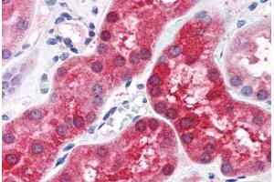 Human Kidney (formalin-fixed, paraffin-embedded) stained with ABHD4 antibody ABIN351489 at 3. (ABHD4 抗体  (AA 177-187))