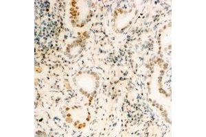 Immunohistochemical analysis of FUBP3 staining in human kidney formalin fixed paraffin embedded tissue section.