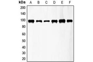Western blot analysis of FGFR3 expression in HeLa (A), A549 (B), T47D (C), mouse kidney (D), mouse heart (E), rat lung (F) whole cell lysates. (FGFR3 抗体  (Center))