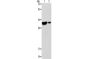 Western Blotting (WB) image for anti-Regulator of Calcineurin 1 (RCAN1) antibody (ABIN2432541) (RCAN1 抗体)