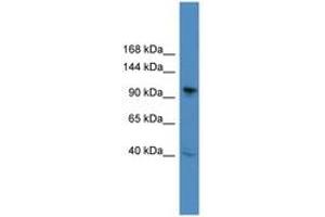 Image no. 1 for anti-B-Cell CLL/lymphoma 11B (Zinc Finger Protein) (BCL11B) (C-Term) antibody (ABIN6745310) (BCL11B 抗体  (C-Term))