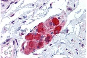 Immunohistochemistry (Formalin-fixed Paraffin-embedded Sections) (IHC (fp)) image for anti-Transient Receptor Potential Cation Channel, Subfamily V, Member 2 (TRPV2) (AA 595-764) antibody (ABIN574136)