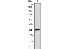 Western blot analysis using CD59 antibody against human CD59 recombinant protein. (CD59 抗体  (AA 31-111))