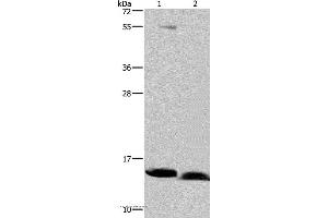 Western blot analysis of Human bladder carcinoma and fetal brain tissue, using NDUFA5 Polyclonal Antibody at dilution of 1:400 (NDUFA5 抗体)