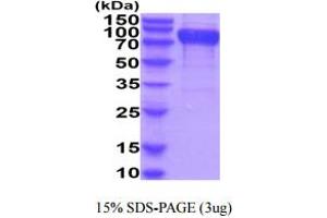 SDS-PAGE (SDS) image for CD96 (CD96) (AA 22-503) protein (His tag) (ABIN5854929) (CD96 Protein (CD96) (AA 22-503) (His tag))