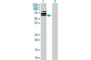 ATP6V1B2 抗体  (AA 1-511)