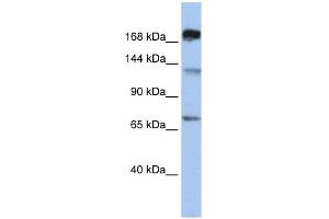 MTR antibody used at 1 ug/ml to detect target protein. (MTR 抗体  (C-Term))