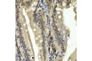 Immunohistochemistry of paraffin-embedded rat Intestine using RBBP5 antibody (ABIN5974189) at dilution of 1/100 (40x lens). (RBBP5 抗体)