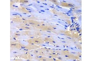 Immunohistochemistry of paraffin-embedded Mouse heart using CUL2 Polyclonal Antibody at dilution of 1:200 (40x lens). (Cullin 2 抗体)