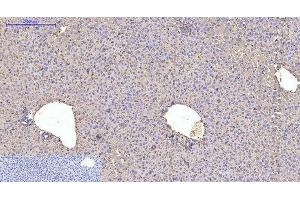 Immunohistochemistry of paraffin-embedded Mouse liver tissue using ACTA1 Monoclonal Antibody at dilution of 1:200. (Actin 抗体)