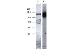 Western Blot analysis using TGM1 antibody Cat. (TGM1 抗体)