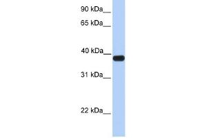 ASB5 antibody used at 1 ug/ml to detect target protein. (ASB5 抗体  (C-Term))