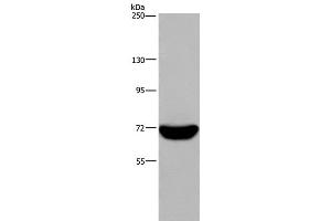 Western Blot analysis of Raji cell using LCP1 Polyclonal Antibody at dilution of 1:300 (LCP1 抗体)
