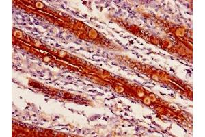 Immunohistochemistry of paraffin-embedded human small intestine tissue using ABIN7143250 at dilution of 1:100 (APEH 抗体  (AA 201-500))