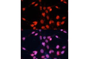 Immunofluorescence analysis of NIH/3T3 cells using FUS antibody (ABIN6127938, ABIN6140818, ABIN6140819 and ABIN7101788) at dilution of 1:100. (FUS 抗体  (AA 297-526))