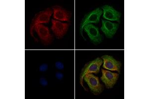 ABIN6261484 and ABIN6279421 staining Hela cells by IF/ICC.