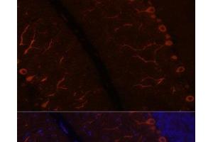 Immunofluorescence analysis of Rat brain using KAL1 Polyclonal Antibody at dilution of 1:100. (KAL1 抗体)