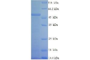 SDS-PAGE (SDS) image for Colony Stimulating Factor 2 Receptor, Alpha, Low-Affinity (Granulocyte-Macrophage) (CSF2RA) (AA 23-320) protein (His-SUMO Tag) (ABIN5709339) (CSF2RA Protein (AA 23-320) (His-SUMO Tag))