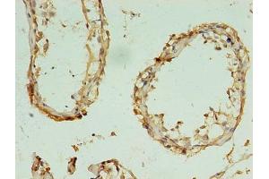 Immunohistochemistry of paraffin-embedded human testis tissue using ABIN7170641 at dilution of 1:100 (RBM11 抗体  (AA 115-278))