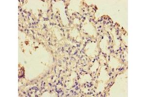 Immunohistochemistry of paraffin-embedded human lung tissue using ABIN7175770 at dilution of 1:100 (WDR54 抗体  (AA 1-334))