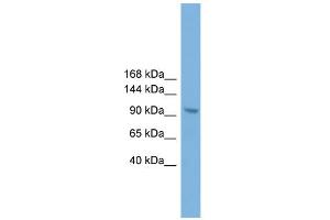WB Suggested Anti-Zhx3 Antibody Titration:  0.
