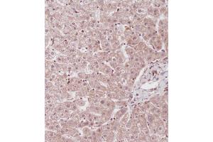 Immunohistochemistry (Paraffin-embedded Sections) (IHC (p)) image for anti-Inhibitor of DNA Binding 1, Dominant Negative Helix-Loop-Helix Protein (ID1) (AA 66-93) antibody (ABIN655663)