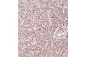 Immunohistochemical analysis of (ABIN655663 and ABIN2845135) on paraffin-embedded Human liver tissue.