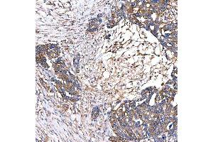 IHC analysis of SLC40A1 using anti-SLC40A1 antibody (ABIN7599484).